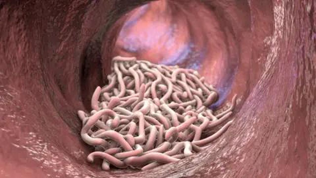 source:BBC World News - Efficacia combinata dei farmaci - Immagine generata al computer di vermi a frusta nell'intestino umano